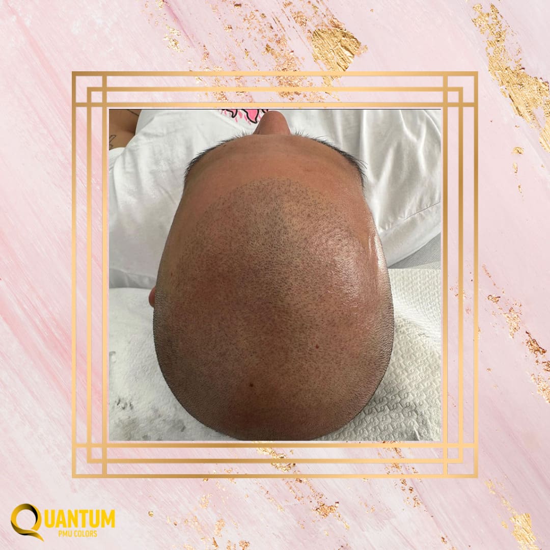 Best Scalp Pigments Best Scalp Pigments